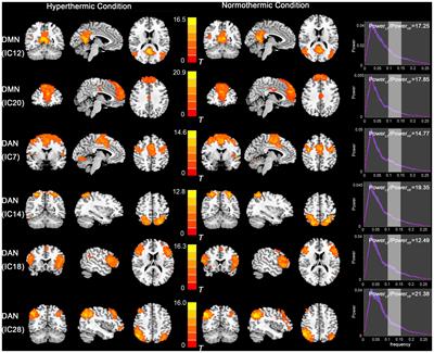Disrupted Anti-correlation Between the Default and Dorsal Attention Networks During Hyperthermia Exposure: An fMRI Study